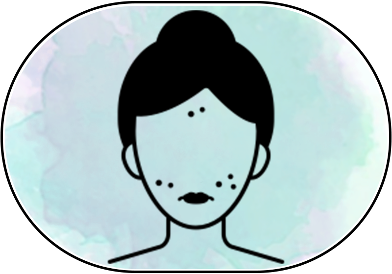 What does Ayurveda say about pimples?