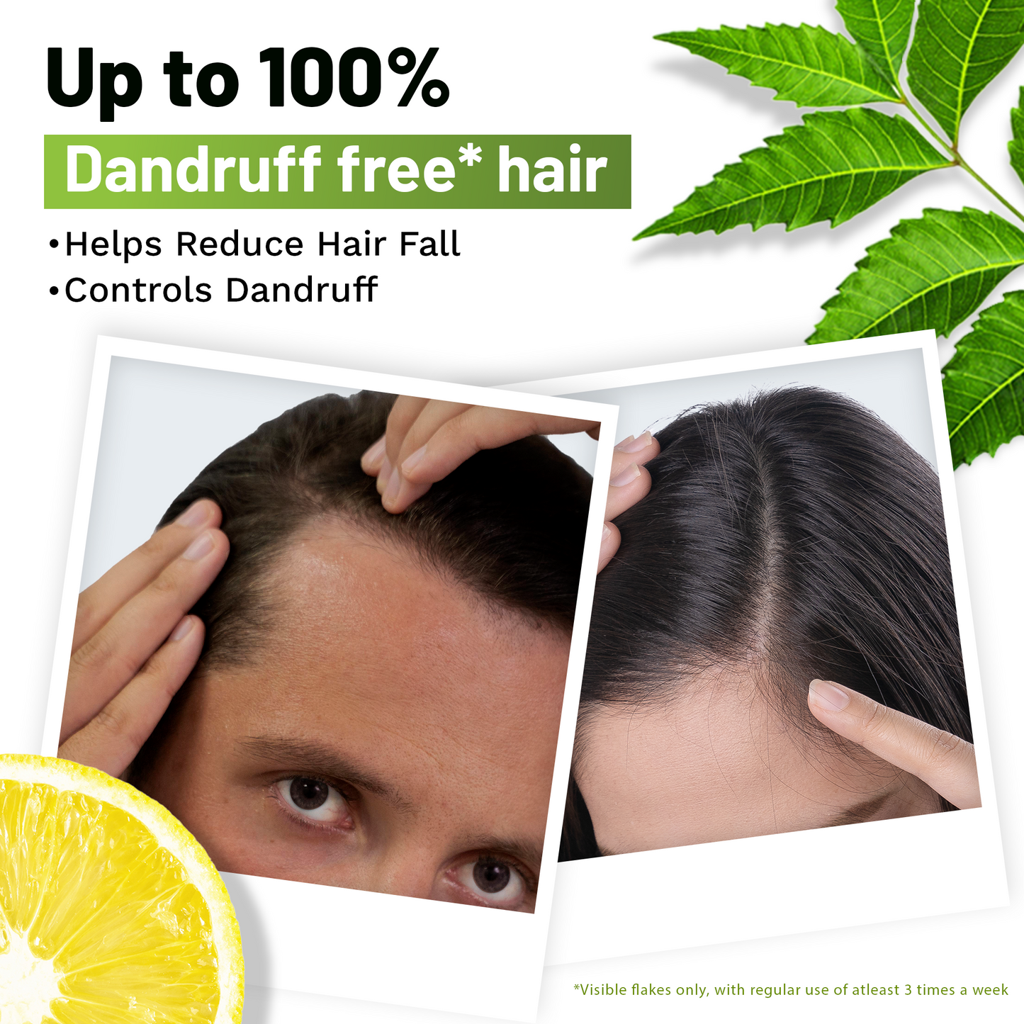 Ayurvedic Anti Dandruff Shampoo