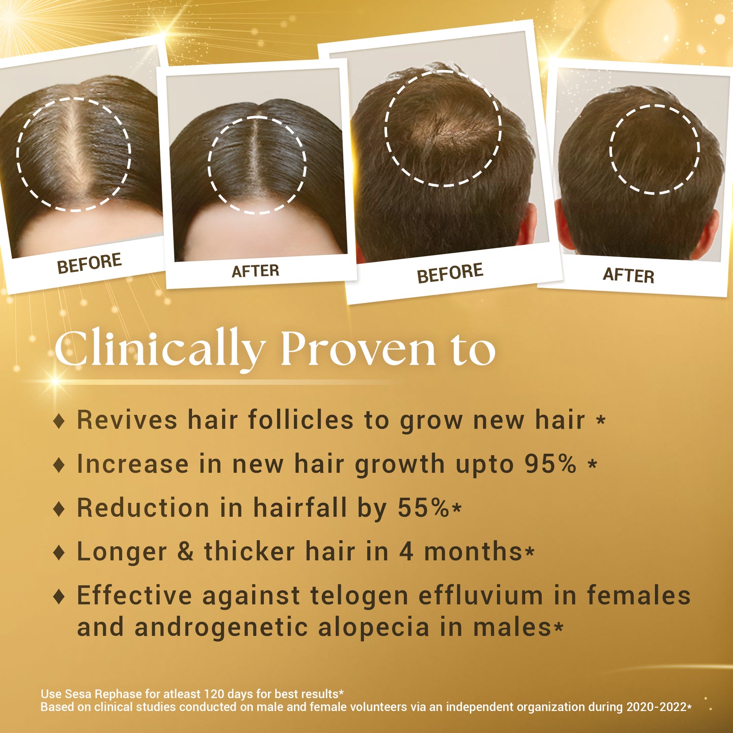 Ayurvedic Rephase - 2 Step Hair Growth Kit (Clinically Proven*)
