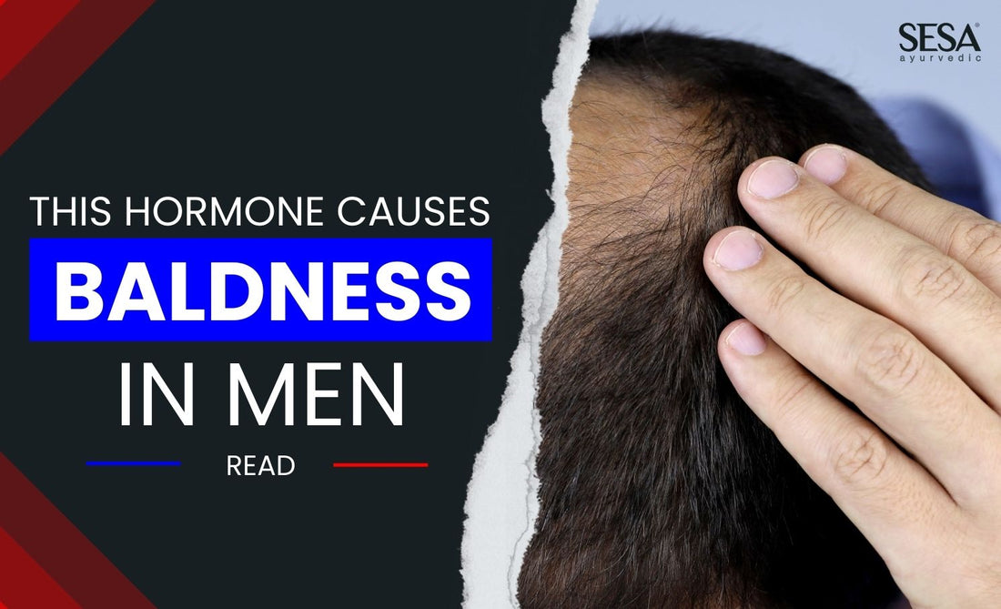 This "Hormone" is the reason why men go bald. Treating hair loss in men