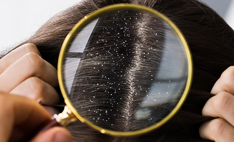 Haircare Is Now Shifting To Scalp-Focused Solutions
