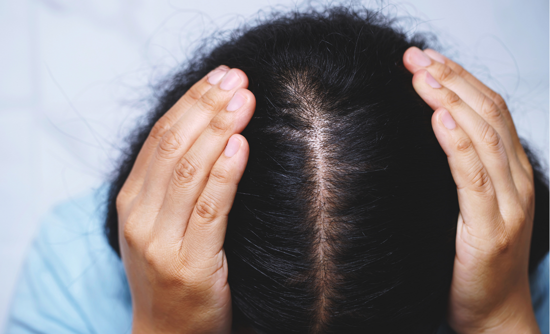 A woman facing hairfall and stunted hair growth