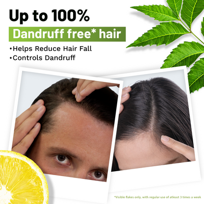 Ayurvedic Anti Dandruff Shampoo