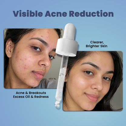 SESA VEDSCIENCE Oil Control Serum, 30 ml