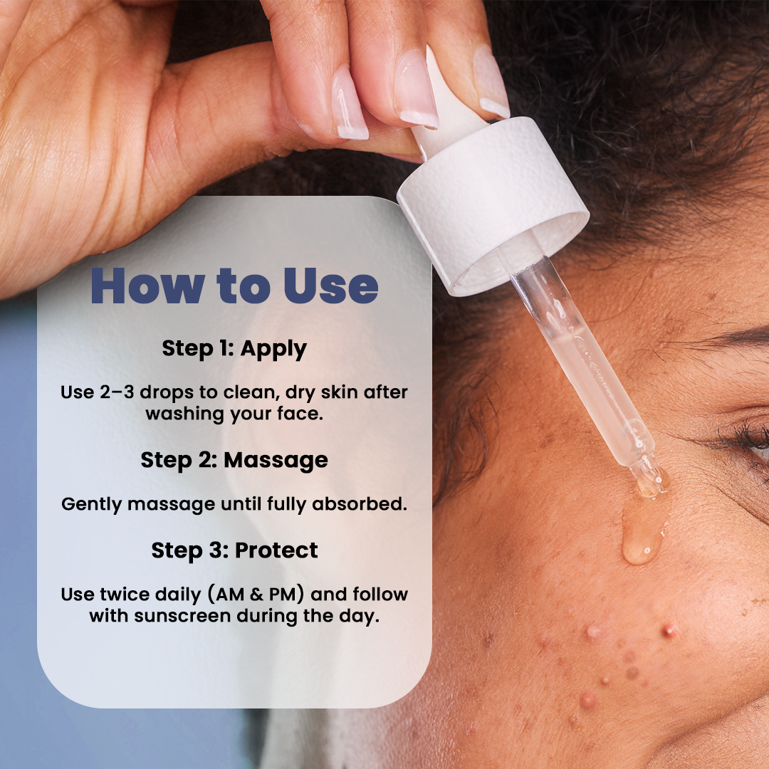 SESA VEDSCIENCE Oil Control Serum, 30 ml