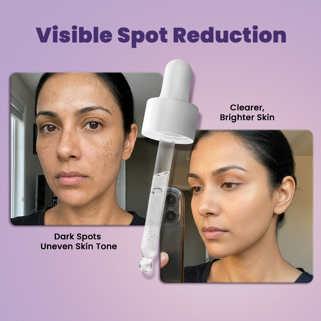 SESA VEDSCIENCE Dark Spot Serum, 30 ml