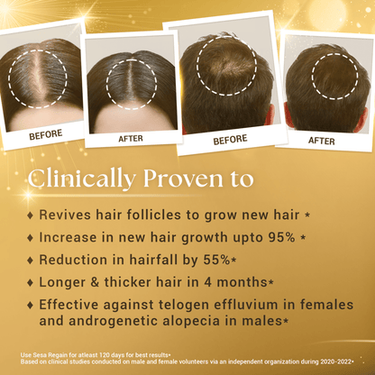 Ayurvedic Regain - 2 Step Hair Growth Kit (Clinically Proven*)